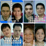 唐氏症 自閉症