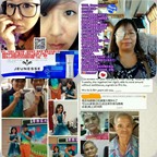 眼睛，眼疾，青光眼