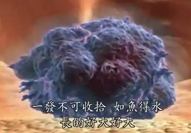 癌症是怎么形成的  大肠癌是怎么形成的